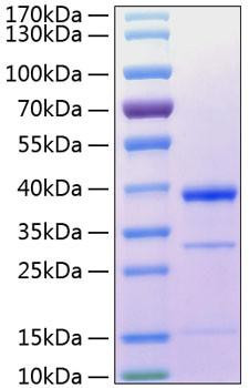 Recombinant Human Cathepsin S Protein (RPCB0329)