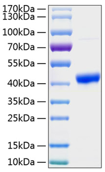 Recombinant Human Osteonectin/SPARC Protein (RPCB0332)