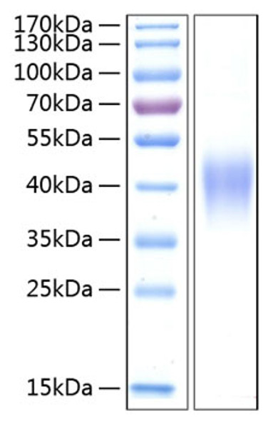 Recombinant Human TNFRSF1B/TNF-R2/CD120b Protein (RPCB0337)