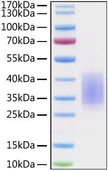 Recombinant Human CD28 Protein (RPCB0352)