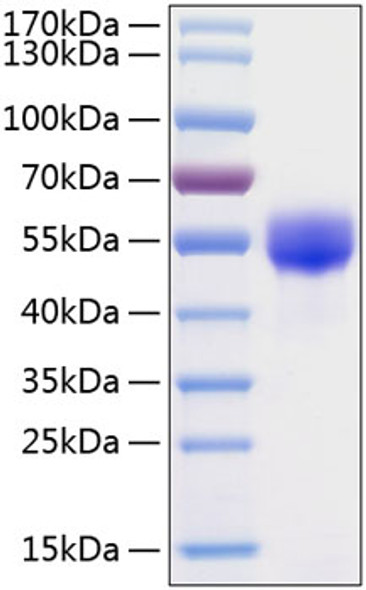 Recombinant Human Fetuin A/AHSG Protein (RPCB0357)