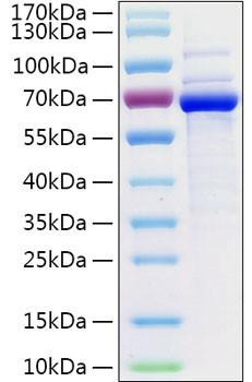 Recombinant Human5'-Nucleotidase/NT5E/CD73 Protein (RPCB0377)