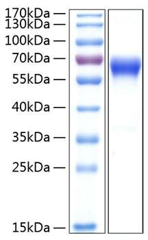 Recombinant Human TNFRSF9/4-1BB/CD137 Protein (RPCB0380)