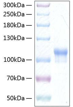 Recombinant Human Neuroligin-3/NLGN3 Protein (RPCB0381)