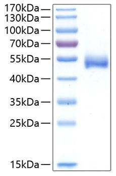 Recombinant Human Chitinase-1/CHIT1 Protein (RPCB0394)