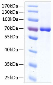 Recombinant Human Serum albumin/ALB Protein (RPCB0411)