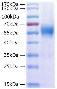 Recombinant Human IL-17RA/CD217 Protein (RPCB0414)