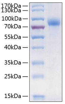 Recombinant Human CSF1R/M-CSF R/CD115 Protein (RPCB0439)
