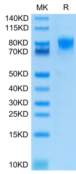 Recombinant Human DNAM-1/CD226 Protein (RPCB0442)