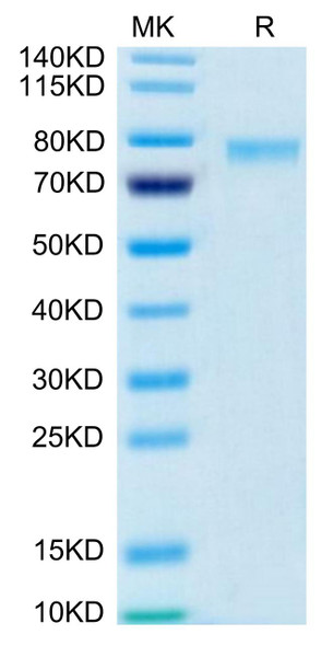 Biotinylated Recombinant Human TNFSF9/4-1BB Ligand Trimer Protein (Primary Amine Labeling) (RPCB0452)