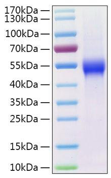 Recombinant Human uPAR/PLAUR/CD87 Protein (RPCB0477)
