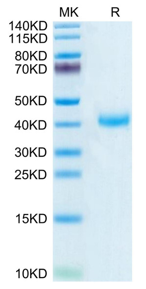 Biotinylated Recombinant Human KLRB1/CD161 Protein (RPCB0509)