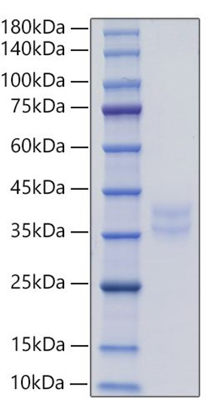 Recombinant Human IL-2RB/CD122 Protein (RPCB0516)