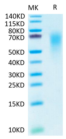 Recombinant Human CEACAM6/CD66c Protein (RPCB0517)