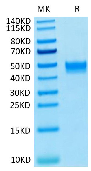 Recombinant Human FGFR-3 beta (IIIb)/CD333 Protein (RPCB0548)
