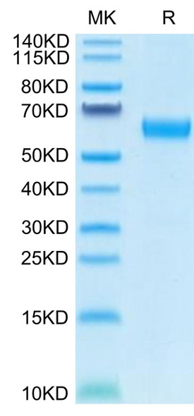 Recombinant Human CD47 Protein (RPCB0557)