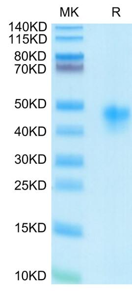 Recombinant Human IL-2 R alpha/CD25 Protein (RPCB0562)