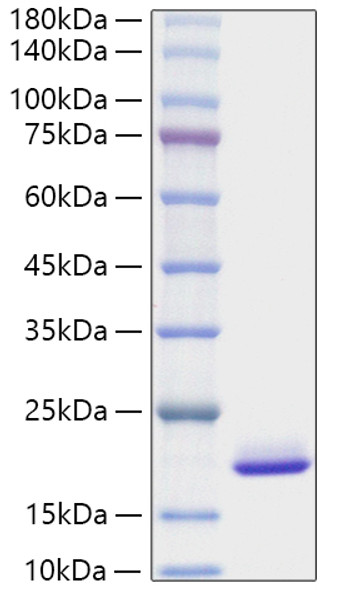 Recombinant Mouse FGF-1/aFGF Protein (RPCB0566)