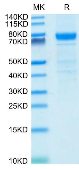 Recombinant Human IL-3RA/CD123 Protein (RPCB0606)