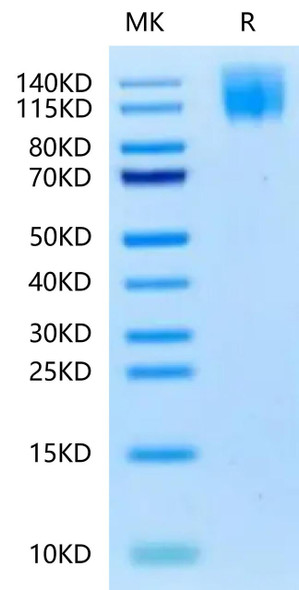 Biotinylated Recombinant Human CEACAM5/CEA/CD66e Protein (RPCB0619)