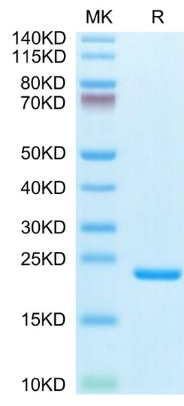 Biotinylated Recombinant Human IL-1 beta Protein (RPCB0621)