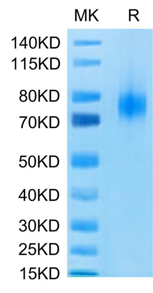 Recombinant Human B7-1/CD80 Protein (RPCB0623)