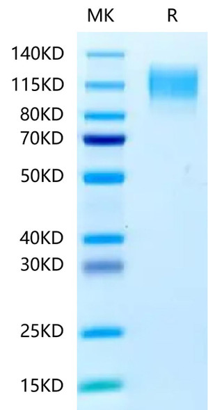 Recombinant Human CEACAM5/CEA/CD66e Protein (RPCB0648)
