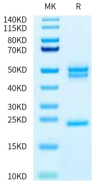 Biotinylated Recombinant Human IL-23A&Mouse IL-12B Protein (RPCB0699)