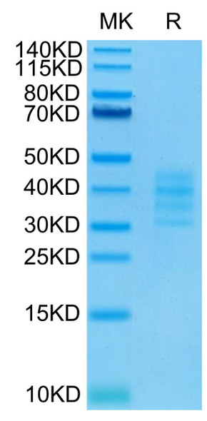 Biotinylated Recombinant Human TNFRSF17/BCMA/CD269 Trimer Protein (RPCB0701)