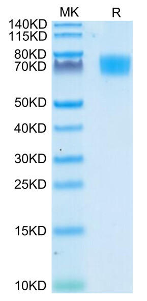 Recombinant Human ALCAM/CD166 Protein (RPCB0706)