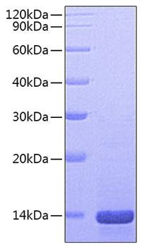 Recombinant Mouse Beta-nerve growth factor/NGFB Protein (RPCB0715)