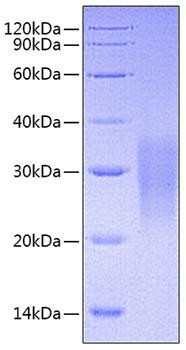 Recombinant Mouse TNFRSF6/FAS/CD95 Protein (RPCB0761)