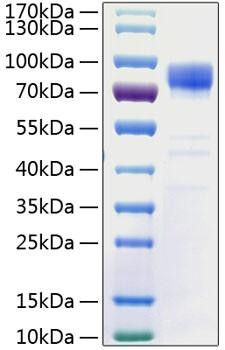 Recombinant Human PSD-95/DLG4 Protein (RPCB0763)