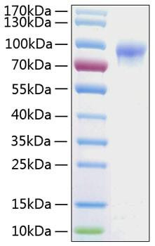 Recombinant Human IL-2RG/CD132 Protein (RPCB0765)