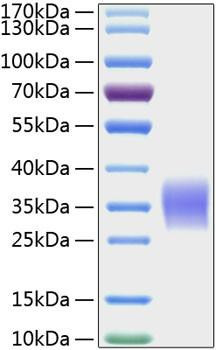 Recombinant Human Activin RIIA/ACVR2A Protein (RPCB0772)
