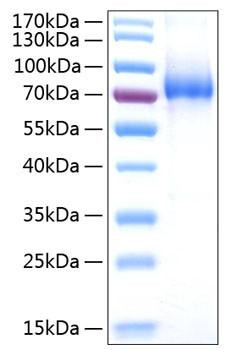 Recombinant Human IL-7RA/CD127 Protein (RPCB0773)