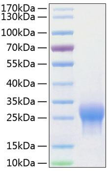 Recombinant Human ALK-1/ACVRL1 Protein (RPCB0774)
