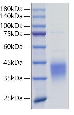 Recombinant Mouse TNFSF9/4-1BB Ligand Protein (RPCB0775)