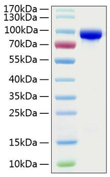 Recombinant Human Transferrin/TF Protein (RPCB0778)