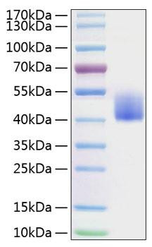 Recombinant Mouse B7-H1/PD-L1/CD274 Protein (RPCB0790)