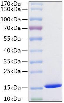 Recombinant Human Cystatin-SA/CST2 Protein (RPCB0803)