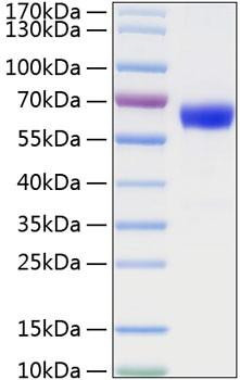 Recombinant Mouse TNFRSF1A/TNF-R1/CD120a Protein (RPCB0816)