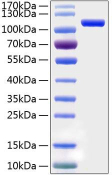 Recombinant Human Semaphorin-5A/SEMA5A Protein (RPCB0820)