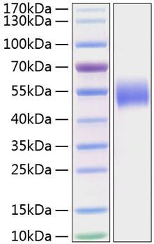 Recombinant Human Nectin-1/PVRL1/CD111 Protein (RPCB0823)