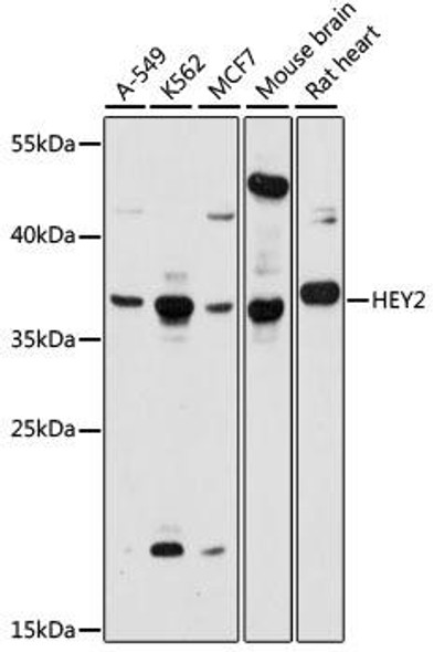 Anti-HEY2 Antibody (CAB15143)