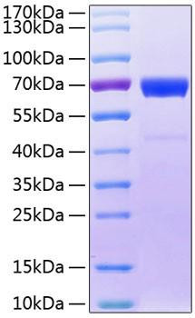 Recombinant Human IL-20RB Protein (RPCB0824)
