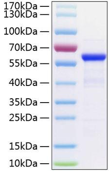 Recombinant Human TET2 Protein (RPCB0838)