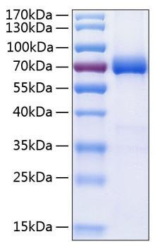 Recombinant Human B7-DC/PD-L2/CD273 Protein (RPCB0841)