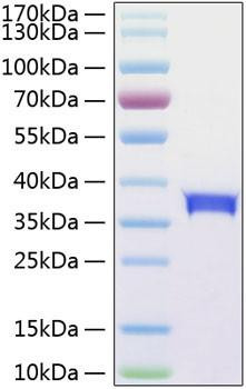 Recombinant Human Siglec-15/CD33L3 Protein (RPCB0851)