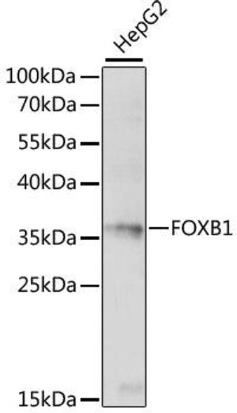 Anti-FOXB1 Antibody (CAB15152)